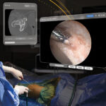 Stryker SportSuite Vision on Apple Vision Pro